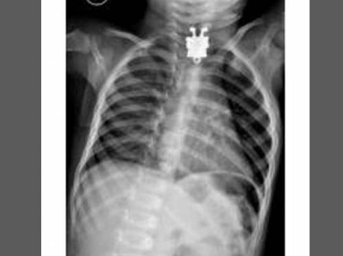 Pazze radiografie: gli oggetti che possono finire nel corpo umano