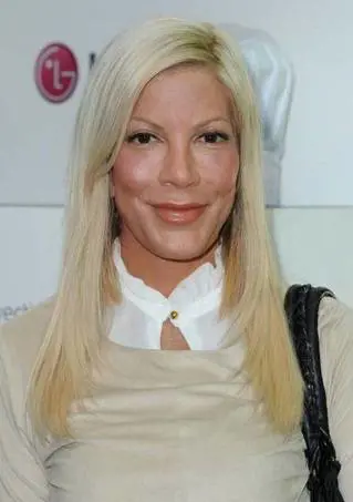 Tori Spelling, il volto deturpato dal botox
