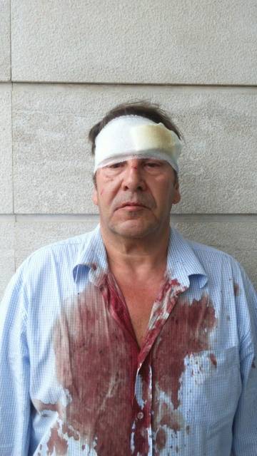 Picchiati brutalmente dai rom giornalista e operatore: "Volevamo solo aiutarli"
