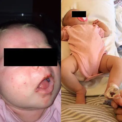 "Non fate baciare i bimbi dagli estranei" La mia ha rischiato di morire