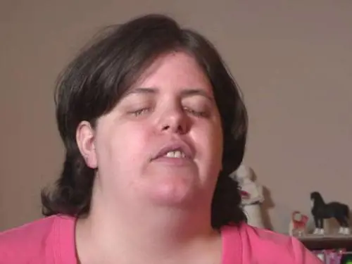 "Volevo essere cieca". E si fa accecare dallo psicologo