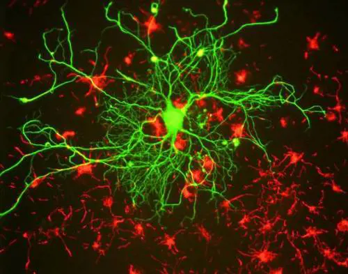 Scoperto il gene che sconfigge il parkinson