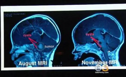 I genitori di una bimba: "Il Papa ha fatto un miracolo per nostra figlia"