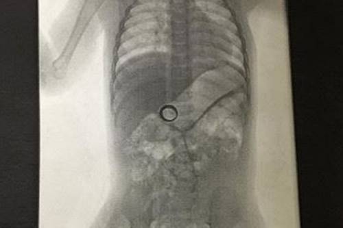 Cerca l'anello ovunque, lo trova nella pancia del figlio