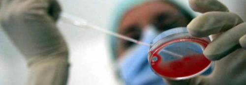 Scoperti 16 geni imputati nella formazione del cancro alle ovaie 