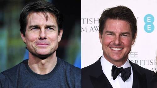L'accusa a Tom Cruise: "Ha usato troppo botox"