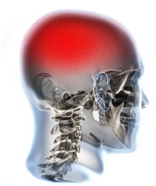 La scoperta dei medici di Torino rivoluziona la lotta al mal di testa 