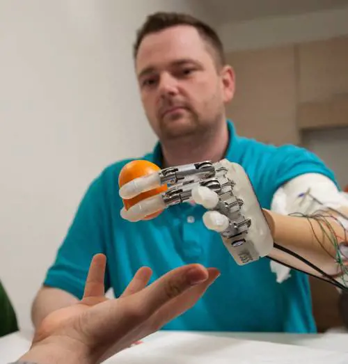 Quel polpastrello bionico che ridà il tatto agli amputati