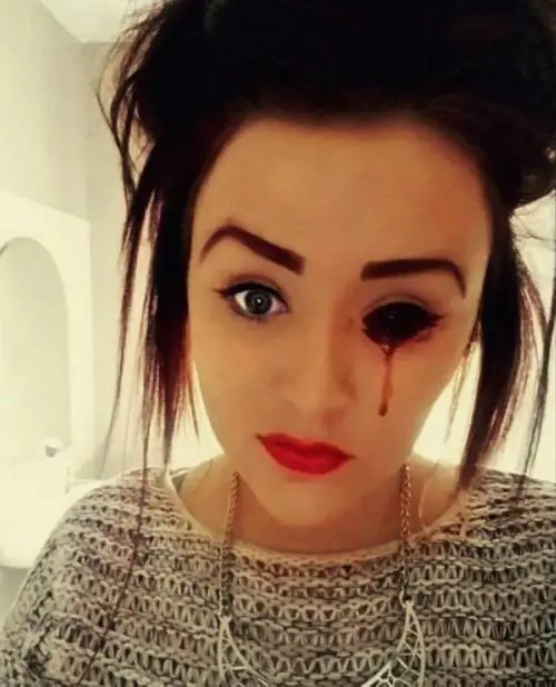 Ragazza perde sangue dagli occhi, ma la sua malattia è sconosciuta