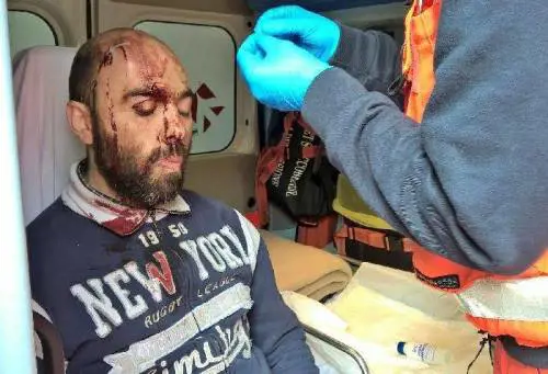 Raccolgono cibo per italiani poveri: bastonati da anarchici e immigrati