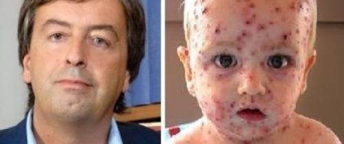 Il professore: "Non vaccinate i vostri figli? Ecco cosa gli succede"