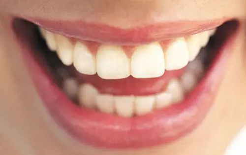 Quel morso doloroso al ghiacciolo. Come spazzolare i denti