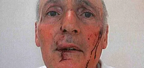 Albenga, rissa fra preti: "Sangue nel seminario"