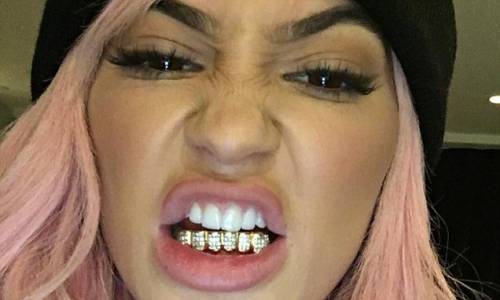 Kylie Jenner sfoggia su Instagram i nuovi denti d'oro