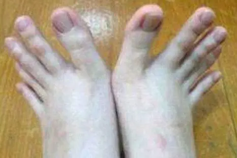Ma sono mani o piedi? La foto fa impazzire il web
