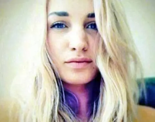 Allergica alle noccioline. Bacia un ragazzo e muore