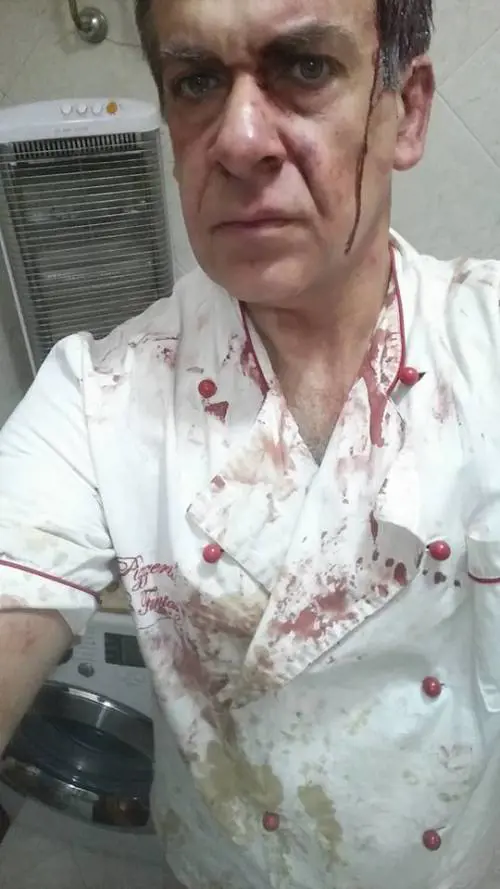 Napoli, accoltella ladro in pizzeria poi pubblica le foto su Facebook