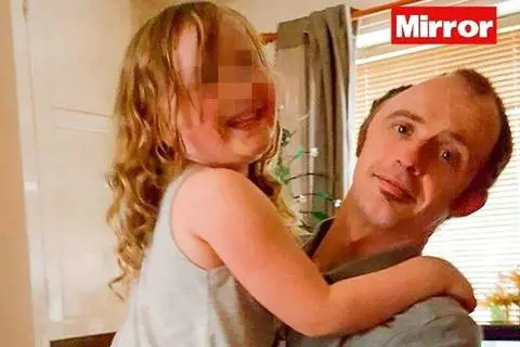 Aggredito per il cellulare, gli viene asportata parte del cranio: "Mia figlia pensa che sia Frankenstein"