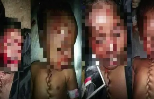 I cadaveri dei bimbi "ricuciti": l'orrore dei trafficanti di migranti