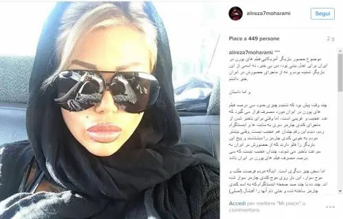 Pornostar si rifà il naso a Teheran. Gli iraniani: "Chi ti ha fatto entrare?"