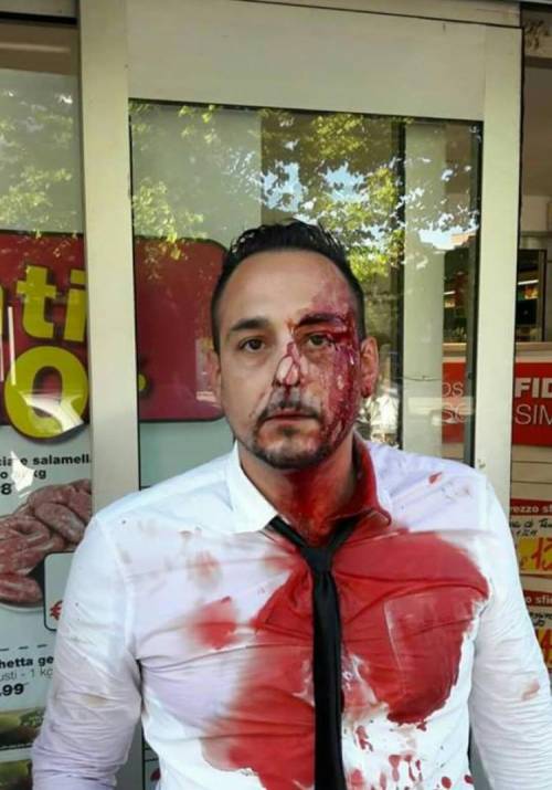"Ho fermato un ladro romeno, mi ha rotto la bottiglia in faccia"