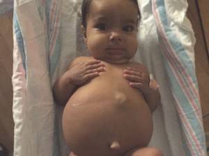 Pubblica le foto choc ​della figlia malata al fegato: "Donate"