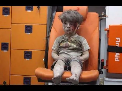 Il padre di Omran accusa i ribelli: "Soldi per le foto anti Assad"