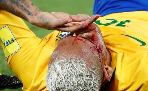 Neymar trascina il Brasile contro la Bolivia e va ko per una gomitata