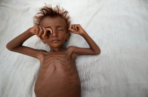 Se i bambini morti in Yemen valgono meno di quelli siriani