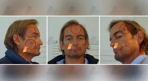 Omicidio Ferrara, i segni sul volto di Cagnoni