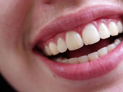 Denti: ecco come mantenerli sani e belli