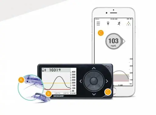 Un sistema che migliora la vita dei diabetici
