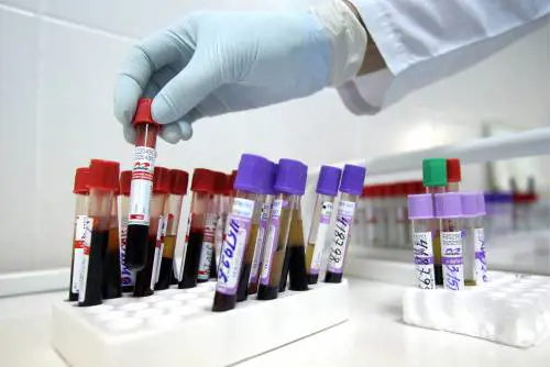In Italia il test fai-da-te per l'Hiv arriva anche nelle farmacie