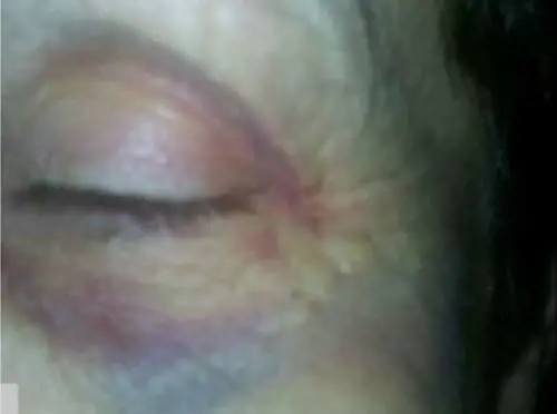 Arezzo, badanti maltrattano anziana invalida