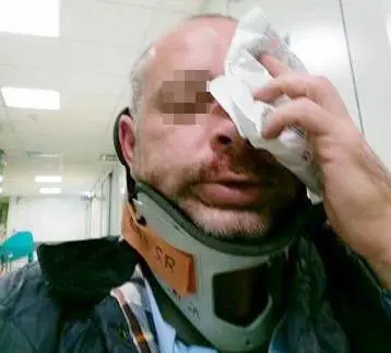 L'autobus salta una fermata, uno straniero pesta l'autista