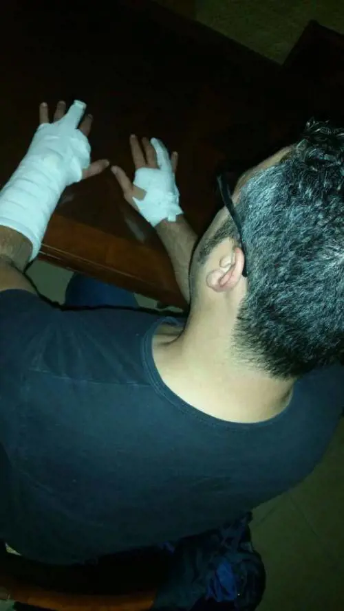 Arresta spacciatore che lo picchia. Ma "ai domiciliari" finisce il poliziotto