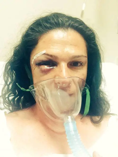 Senatrice cade dalla moto. E in quattro la pestano a sangue