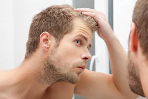Il trapianto di capelli è definitivo? Tutto quello da sapere