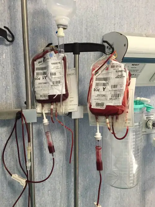 Cina, solo figlia può salvarla. Pronta a donare midollo a 8 anni