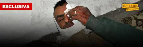 "Io, sotto il fuoco dell'Isis. Sangue a pochi metri da me"