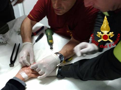 Roma, anello incastrato al dito: i medici chiedono aiuto ai pompieri