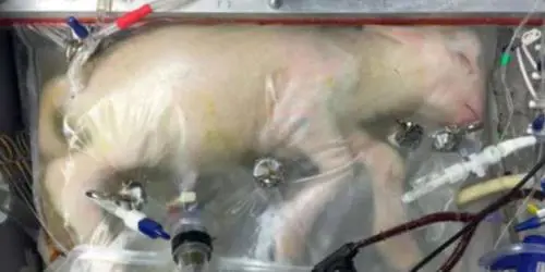 Questo sacchetto di plastica può salvare la vita dei bimbi prematuri