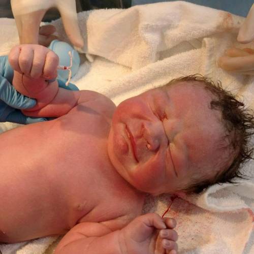 Usa, il bambino nasce tenendo in mano il contraccettivo della madre
