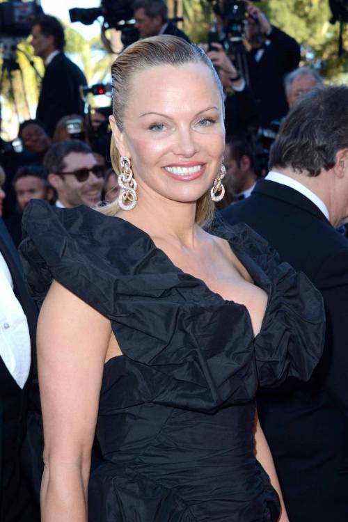 Cannes, Pamela Anderson sul red carpet con il braccio pieno di lividi