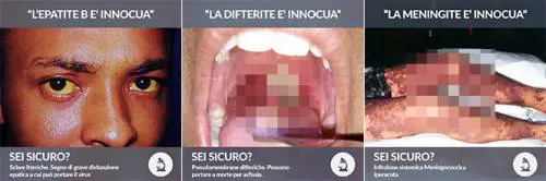 Vaccini, foto choc sulle malattie "Così muore chi non si vaccina"