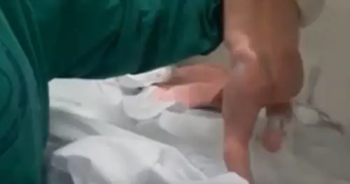 Brasile, bambina "cammina" pochi minuti dopo la nascita