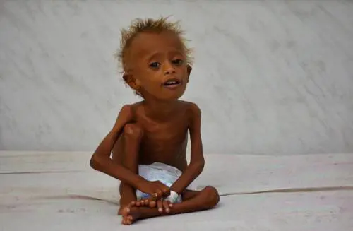 Quelle prigioni segrete in Yemen dove si torturano i bambini