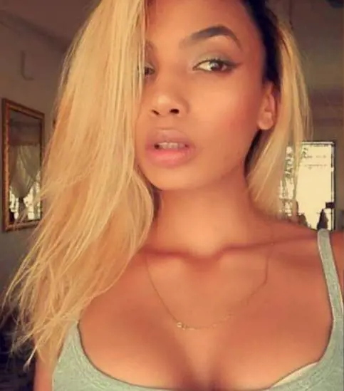 Modella picchiata dalla first lady dello Zimbabwue