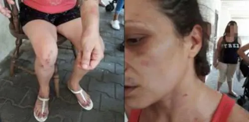 Pamela, la donna aggredita dagli immigrati al centro di accoglienza del Tiburtino III