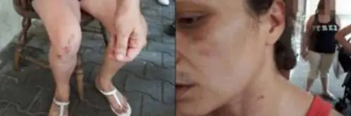 Eritreo ferito, donna indagata per lesioni aggravate